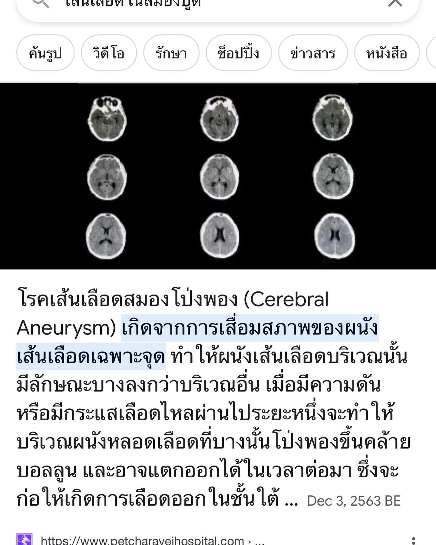 กวาง - วรรณปิยะ ออมสินนพกุล