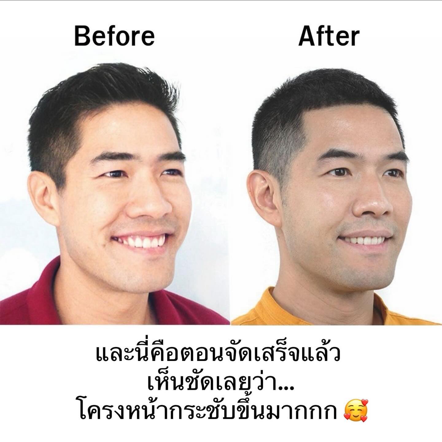 วู้ดดี้ - วุฒิธร มิลินทจินดา