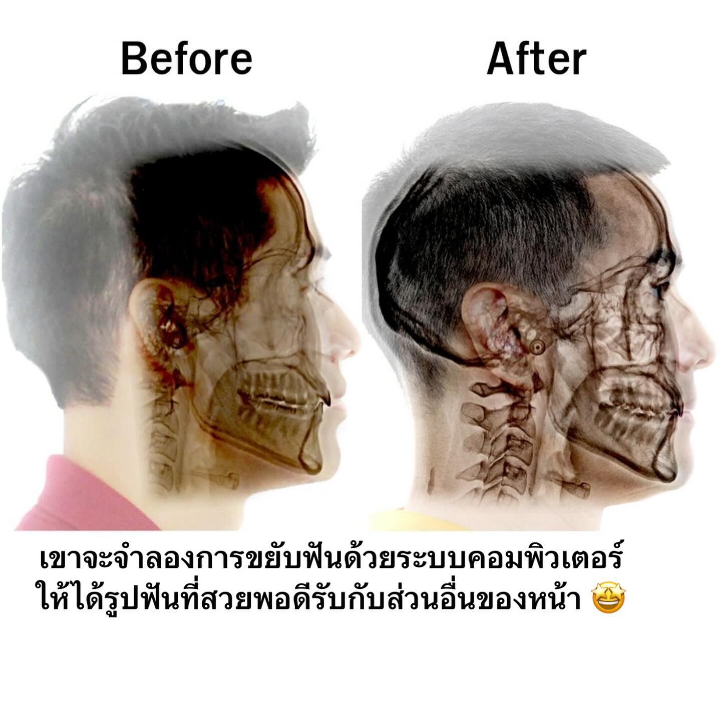 วู้ดดี้ - วุฒิธร มิลินทจินดา