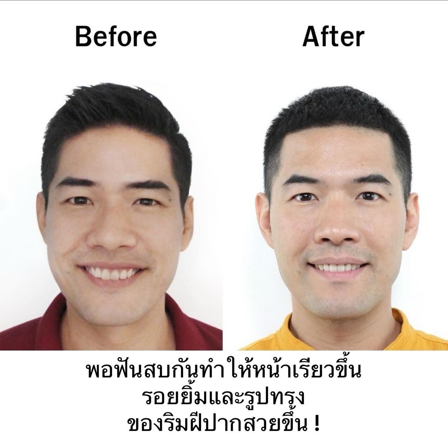 วู้ดดี้ - วุฒิธร มิลินทจินดา