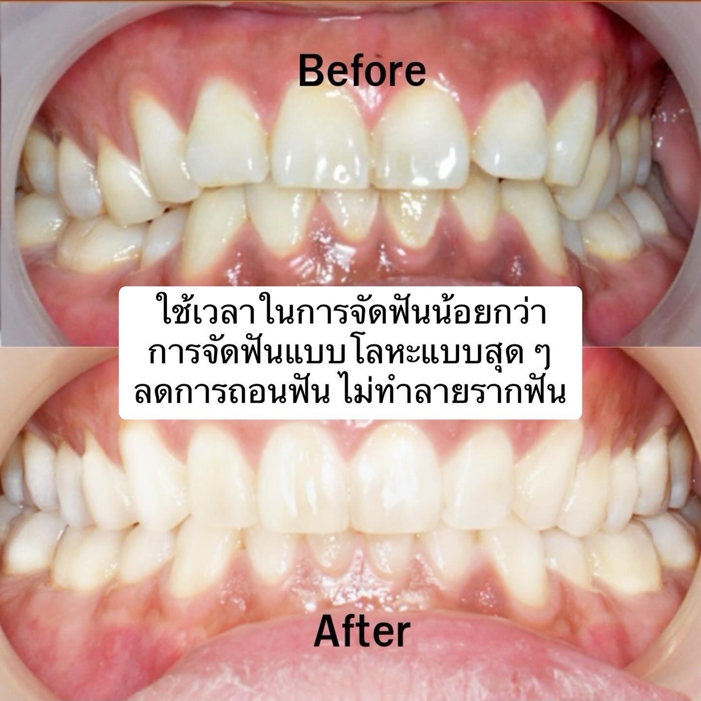 วู้ดดี้ - วุฒิธร มิลินทจินดา