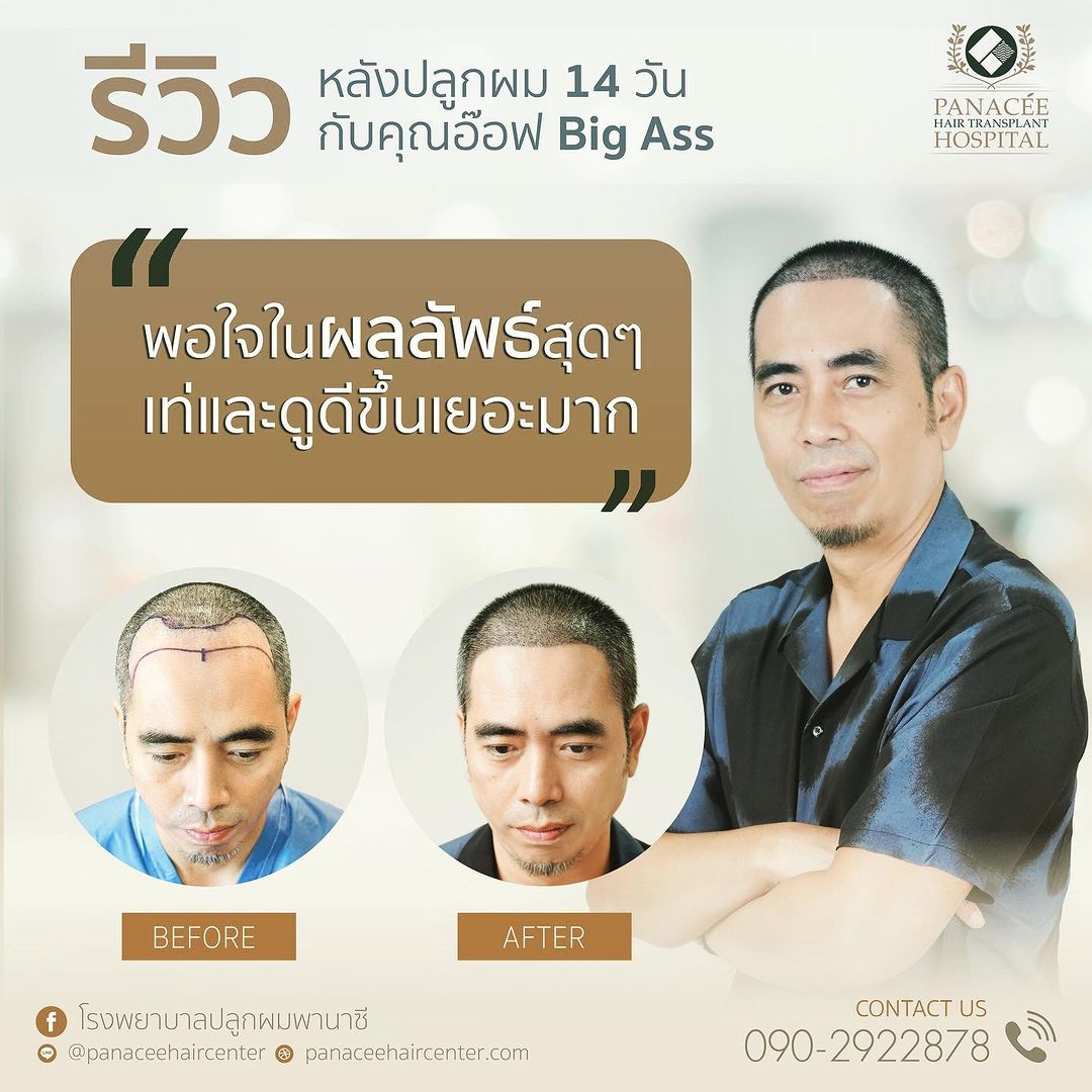 อ๊อฟ - พูนศักดิ์ จตุระบุล