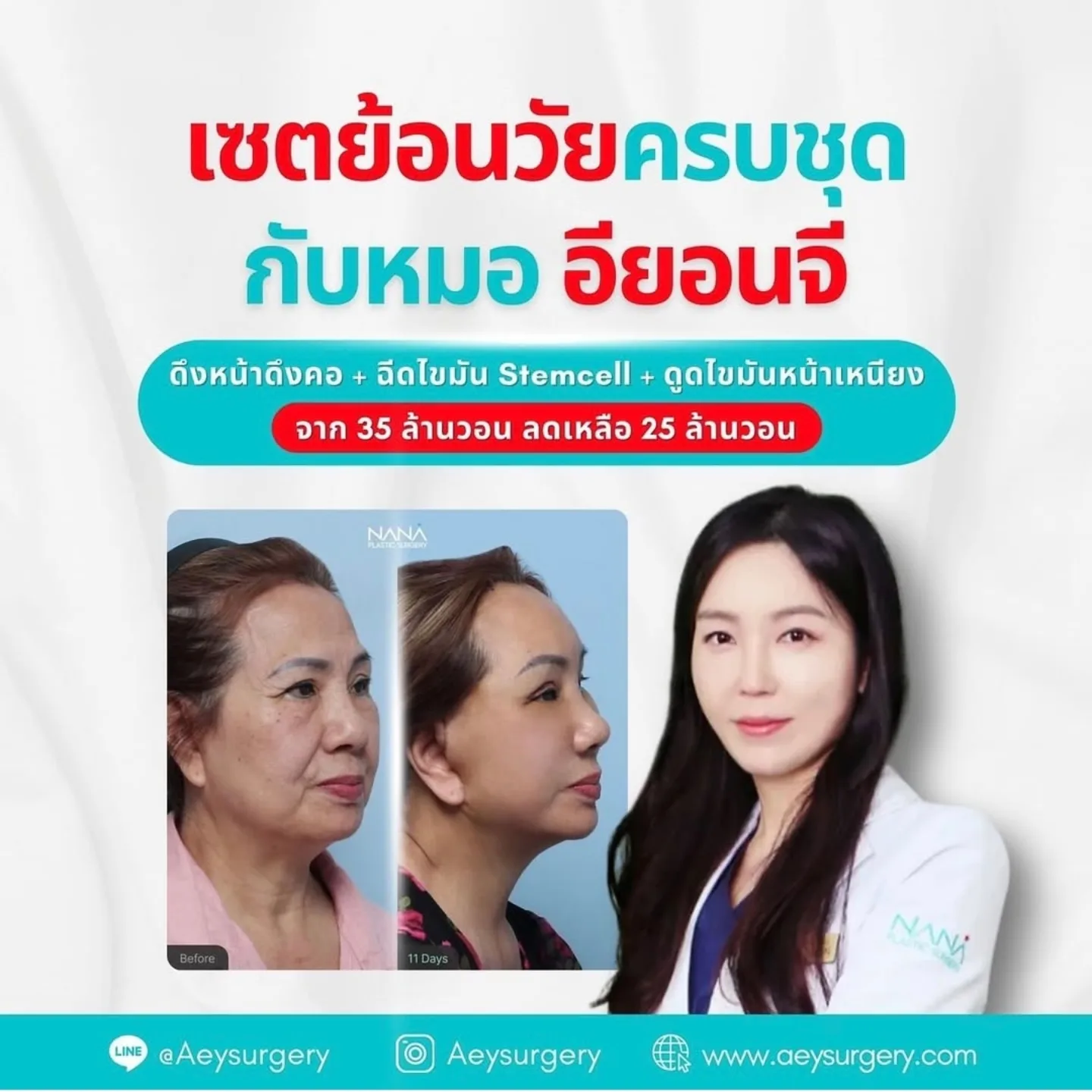 นิกกี้ - นิโคล เทริโอ