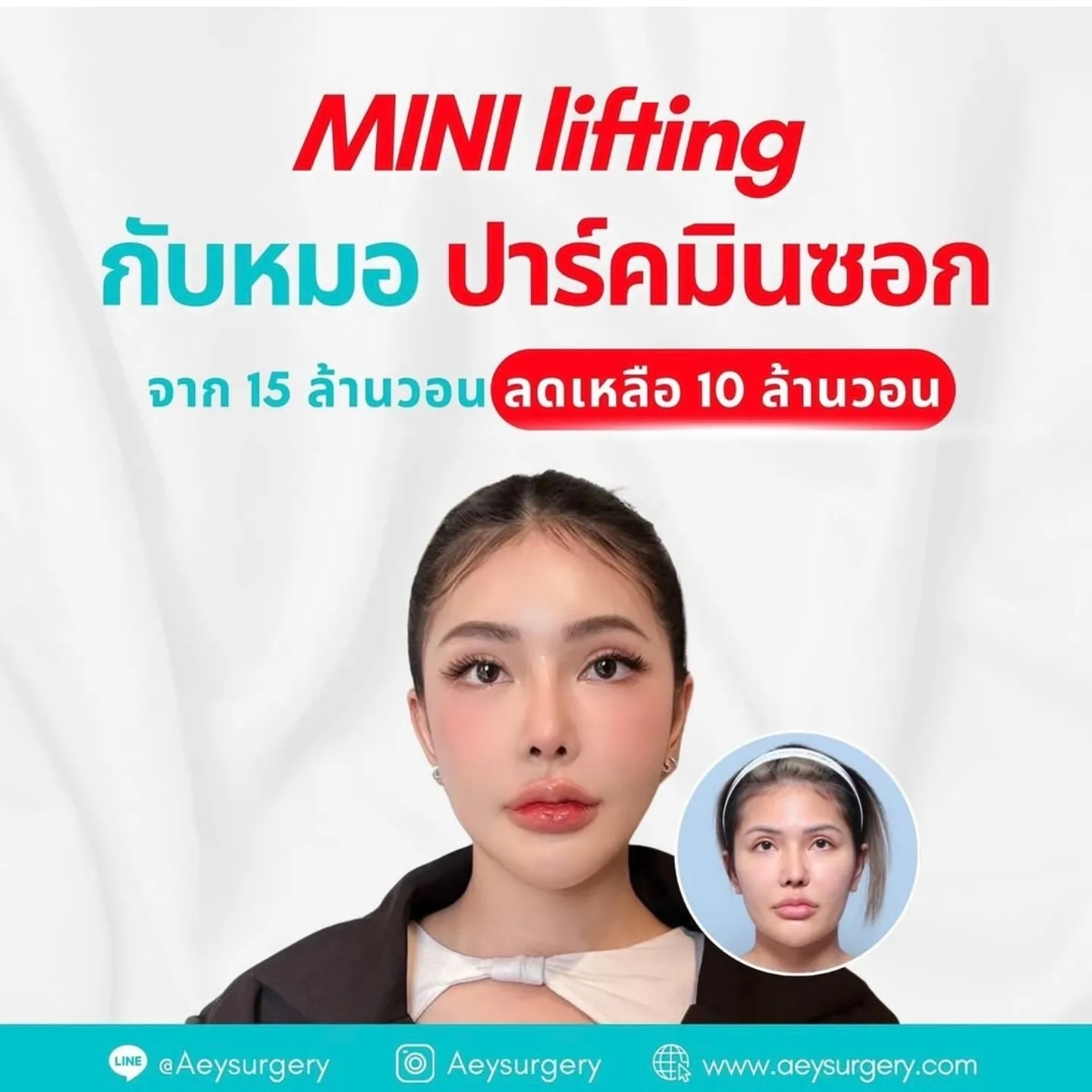 นิกกี้ - นิโคล เทริโอ