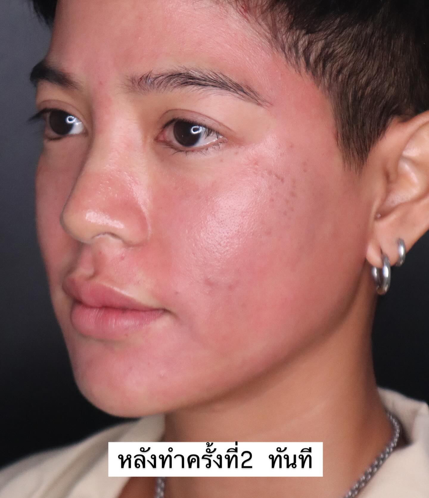 สายป่าน - อภิญญา สกุลเจริญสุข